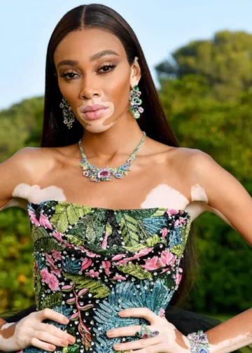 Winnie Harlow